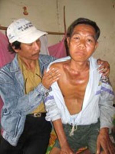 AidsVnCambodia150.jpg