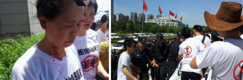 居民示威期間，當局派來數百特警，特警搶走示威者的抗議橫額，並暴力驅散示威者。衝突期間，十多人被特警打傷，部份人更被抓捕，拘留至當晚深夜才獲釋。圖為其中一名被打傷的婦女。（居民陳先生提供）