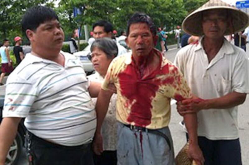 5月27日，福建省福州市政法委書記帶領近兩百名強徵人員進入嶼宅村強行收地，與村民爆發衝突，有村民被打傷頭部。（村民劉先生提供） 