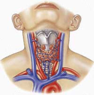 ThyroidCancer200.jpg