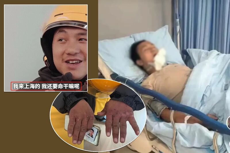 陳思在今次意外前，雙手已滿佈凍瘡和傷痕。