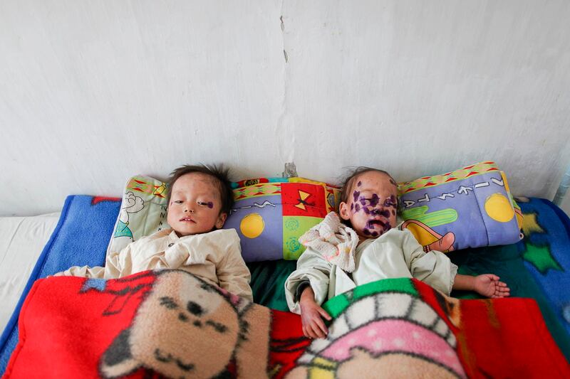 ENG_KOR_FoodShortage_04242024.2.jpg