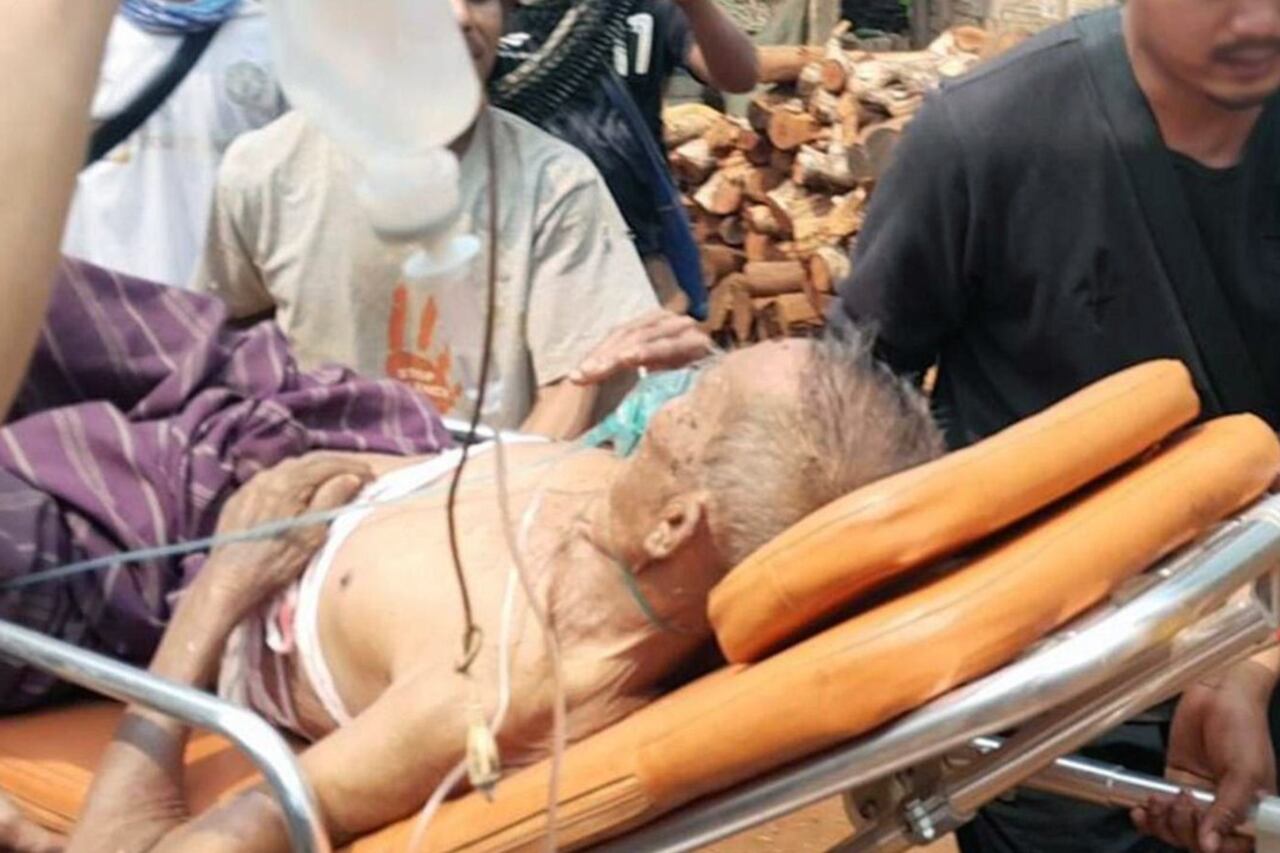 ဒီးမော့ဆိုမြို့နယ်မှာ လက်နက်ကြီးကြောင့် ထိခိုက်ဒဏ်ရာရသူကို ၂၀၂၃ ခုနှစ် ဖေဖော်ဝါရီလ ၂၇ ရက်နေ့ကတွေ့ရစဉ်။