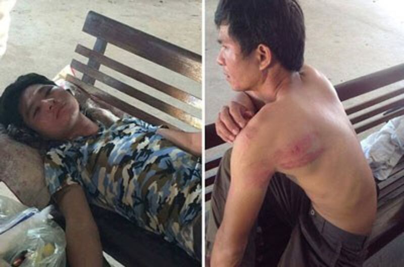 Các nạn nhân trong vụ khủng bố ngày 9/7/2016 ở Nghệ An. Citizen photo.