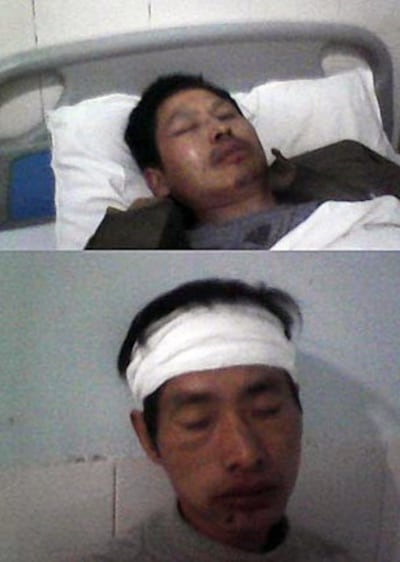 图片:当局强拆彭州隆丰镇村民被打 (村民提供)