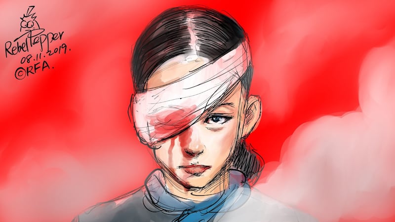 变态辣椒:香港爆眼女孩重回公众面前