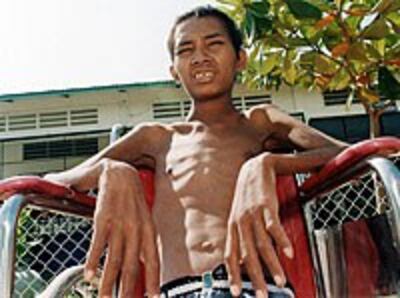 CambodiaAIDS200.jpg