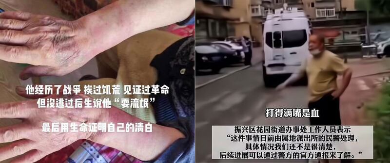 左图:网民感叹这位老人经历过战争、饥荒及文革,但逃不过疫情。 右图:当地街道办工作人员指案件由警方处理。(视频截图)