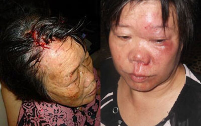 2012年9月22日凌晨，廣東潮安縣防暴警察突然闖入彩塘鎮華二村，打傷抗議村官貪腐的村民，有女村民和老人被打。（村民李先生提供）