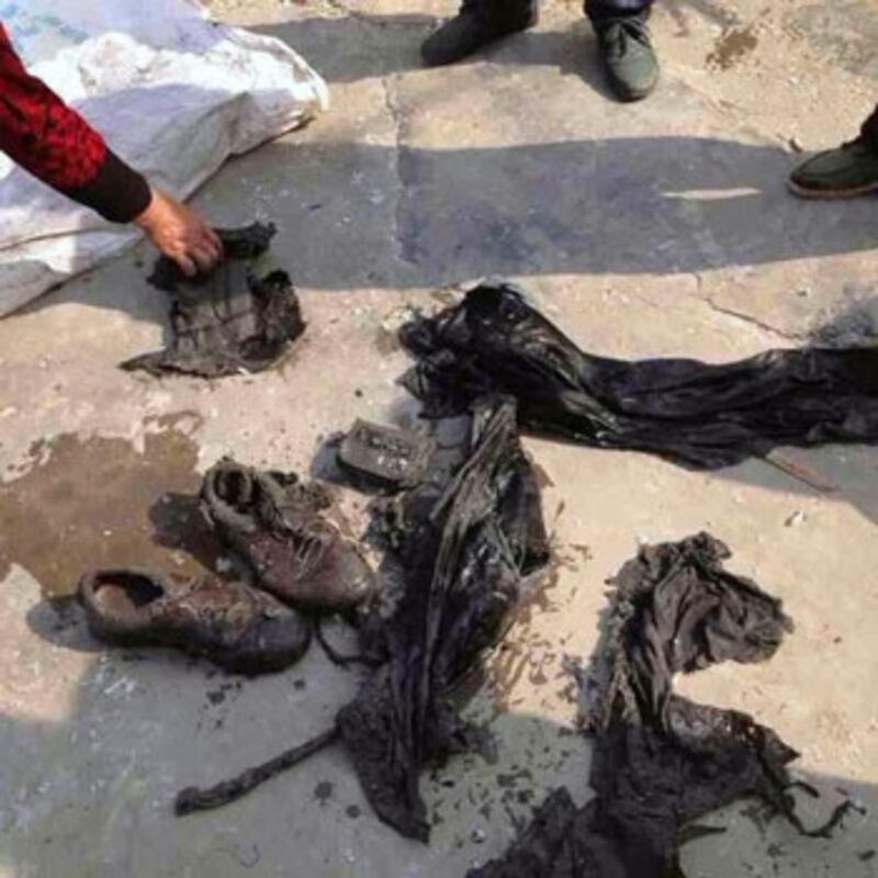 陳建富身上衣物被燒焦。（陳思提供）