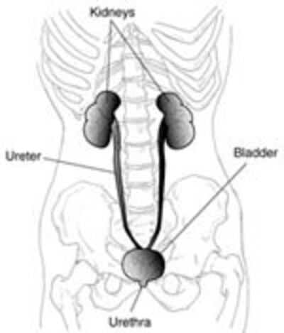 KidneyStone150.jpg