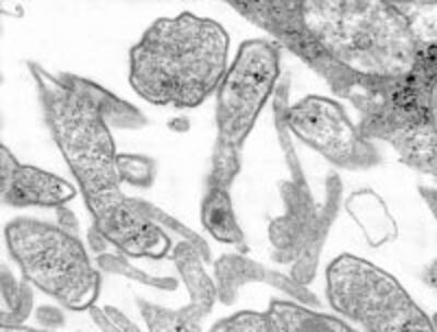 MumpVirus200.jpg